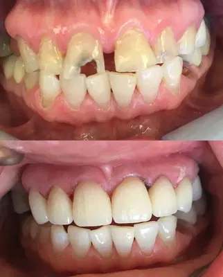 Central Valley Dentistry