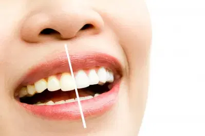 Island Dental - Dentist Gilbert, AZ