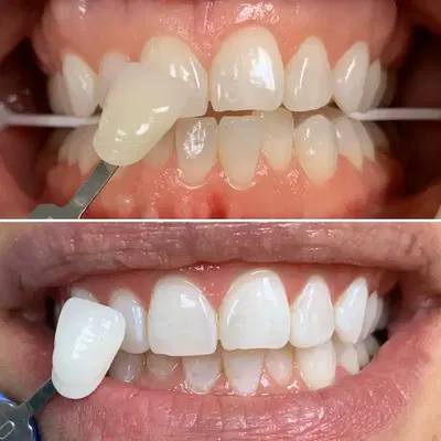 Gilbert Dental Center