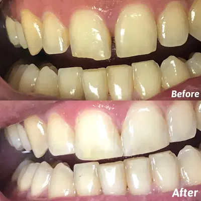 AZ Dental Club