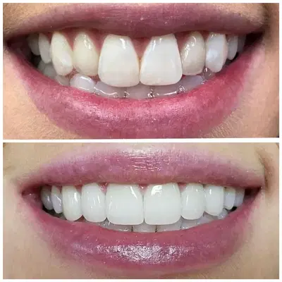 Pure Dental of Murrieta & Orthodontics