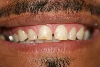 Murrieta Smiles Dentistry