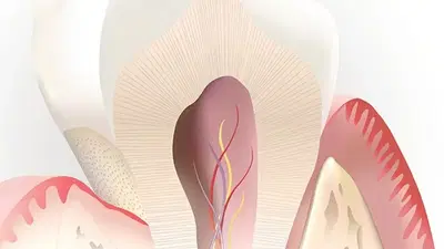 Sacramento Root Canal Specialists