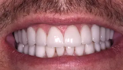 Exquisite Dentistry