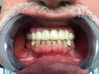 PhD Dental Los Angeles Kids, Implants & Orthodontics