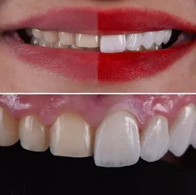 Gentle Care Dental