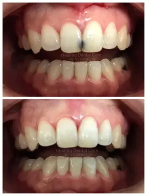 Healing Dental Care | Los Angeles