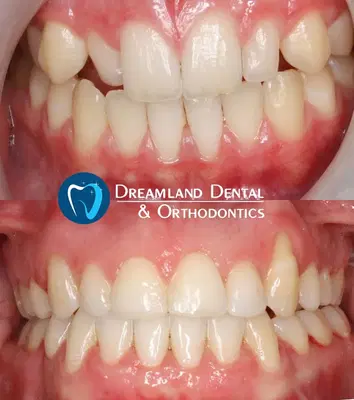 Dreamland Dental & Orthodontics - Dentist Bellflower