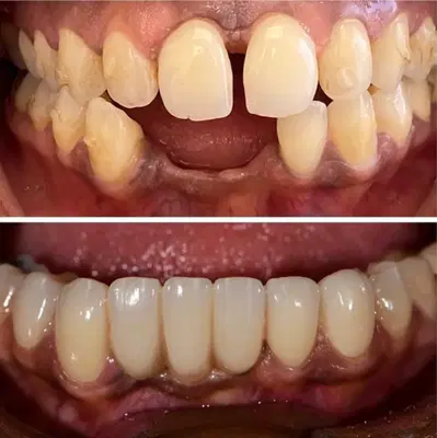 Bayshore Dental Long Beach