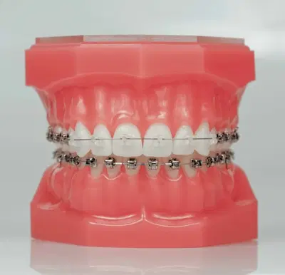 SD Ortho, Smile Design Orthodontics