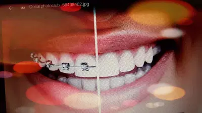 Orthodontic And General Dentistry