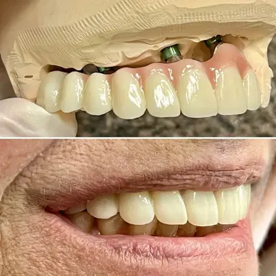 Smile Designers