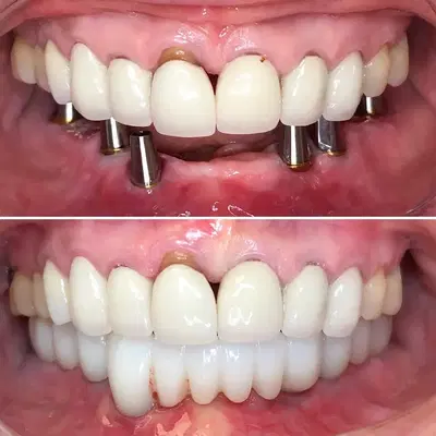 University Dental