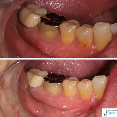 Advanced Dentistry by Design - Invisalign and Sleep Apnea Dentist