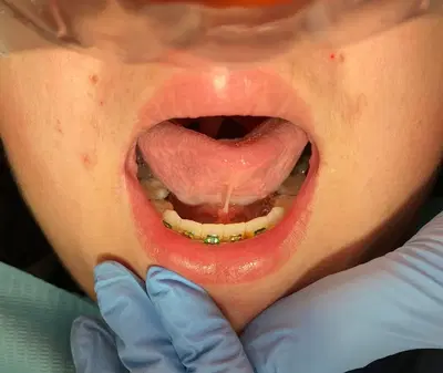 Silicon Valley Pediatric Dentistry and Orthodontics