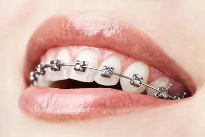 Castillo Dental Group Orthodontics & Implant Center