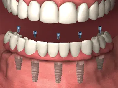 Whitlow Dental Care
