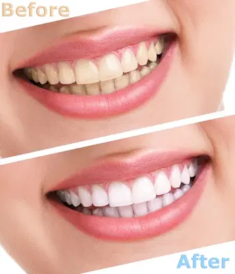 Blessed Smile Dentistry of Mission Viejo