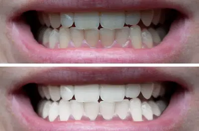Heather Ridge Dentistry