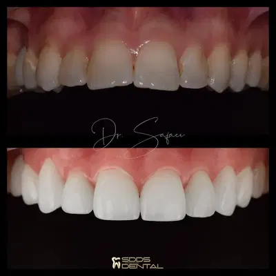 SDDS Dental - Implant, Veneer, Invisalign, and General Dentist
