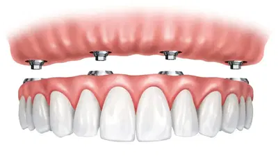 Golden Gate Dental