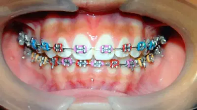 Jorn N. Olimpiada, DDS