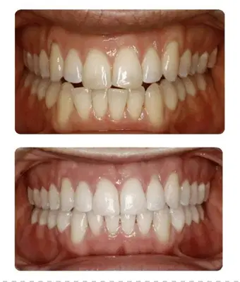 Sunvalley Orthodontics