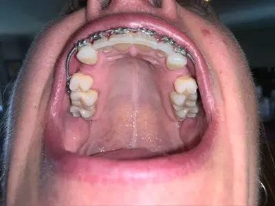 Aurora Orthodontics & TMJ