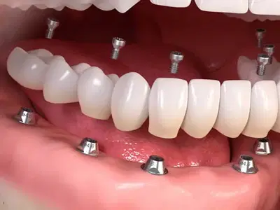 Fit To Smile