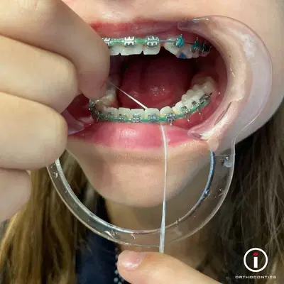 i-Orthodontics Downtown