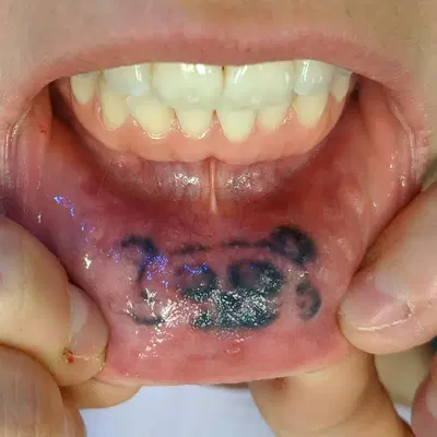 Dental Elements
