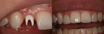 Advanced Dentistry of Connecticut