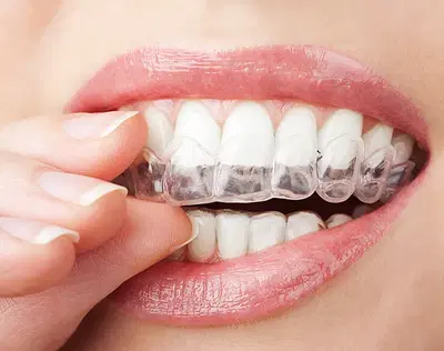 Smiles Dental