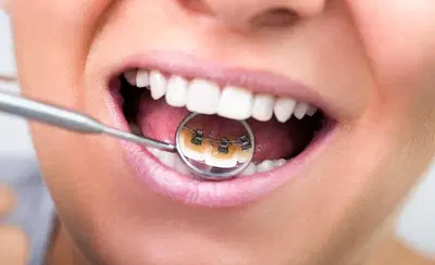 Escott Orthodontics - Orlando