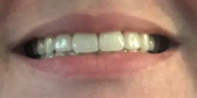 Marsh Orthodontics - William F Marsh DDS
