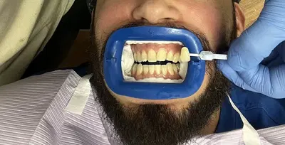 Dental Associates of Florida - Tampa