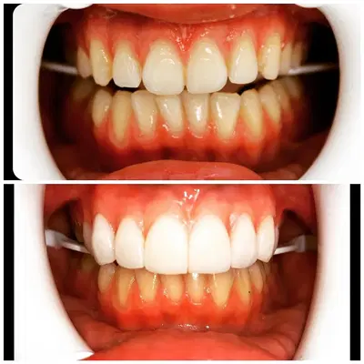 Drubi Dental