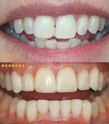 Infinity Dental Associates