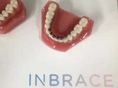 ION Orthodontics