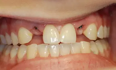 Wickham Dental Care