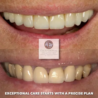 Exceptional Dentistry of Sarasota