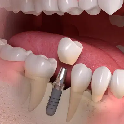 Jacksonville Dental Specialists