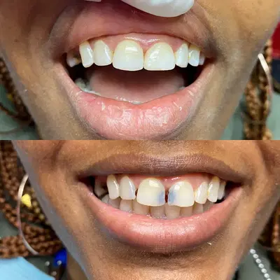 Jacksonville Emergency Dental