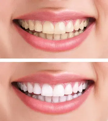 Community Dental Care