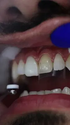 FRESH DENTAL ATLANTA
