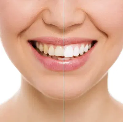 DentFirst Dental Care West Midtown