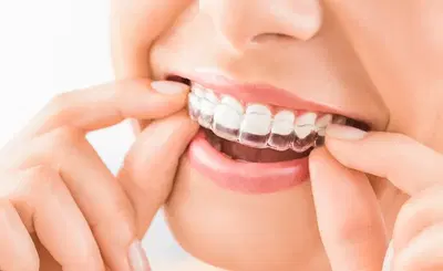 Silver Smiles