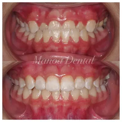 Manoa Dental