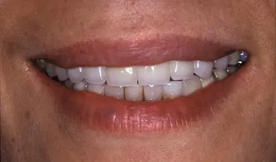 Advanced Restorative Dentistry
