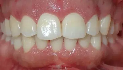 Diamond Plus Orthodontics